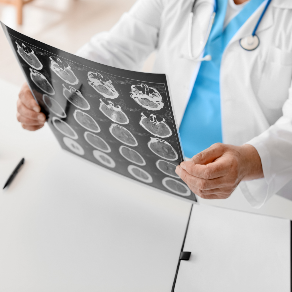 Specijalistički neurološki pregled - Poliklinika Arcadia