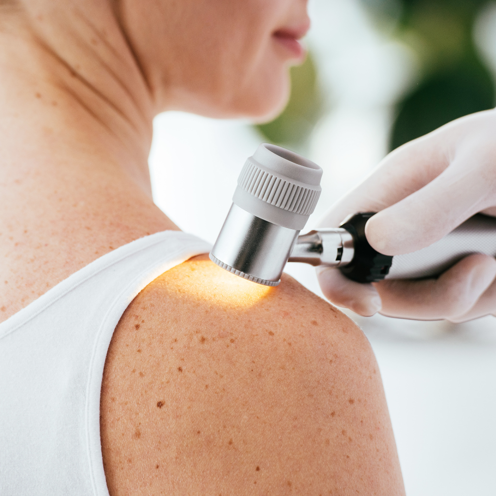 Kontrolni dermatološki pregled - Poliklinika Arcadia
