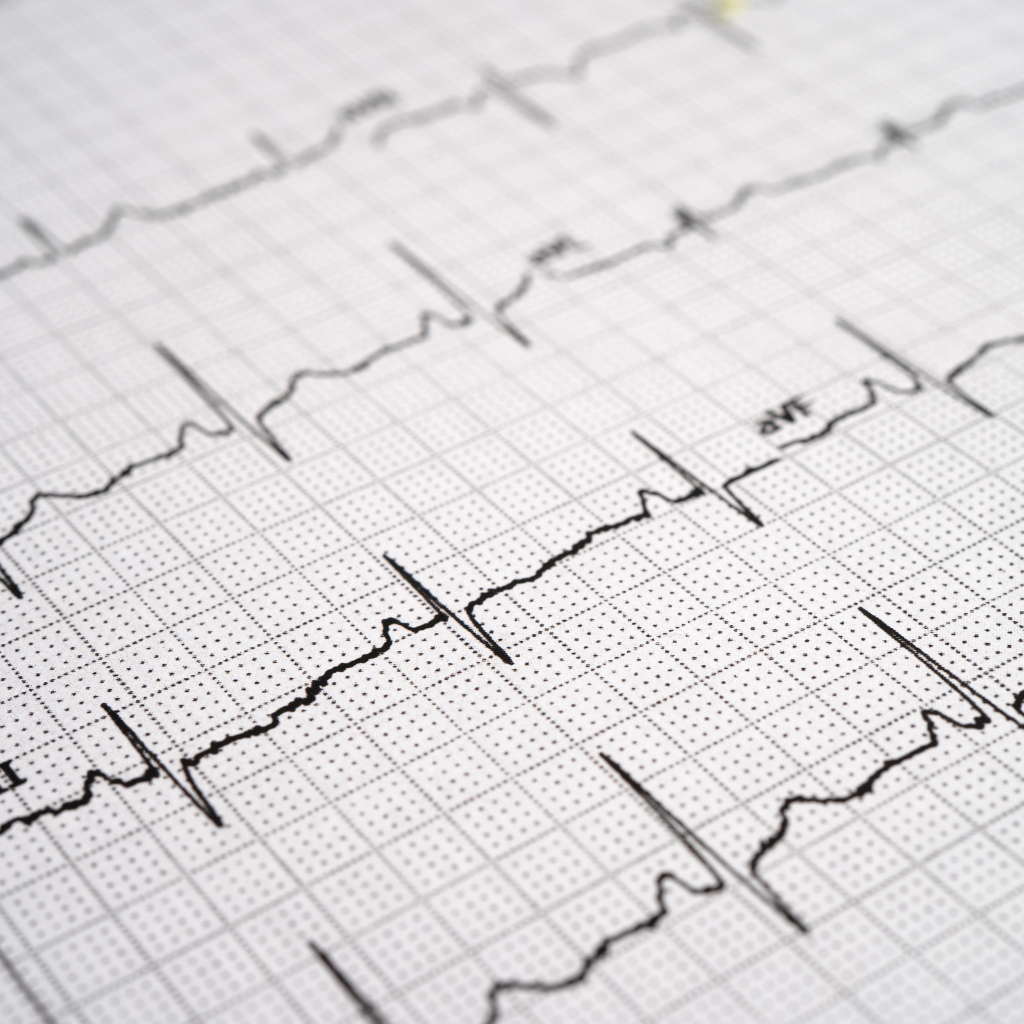 EKG (Elektrokardiogram) - Poliklinika Arcadia