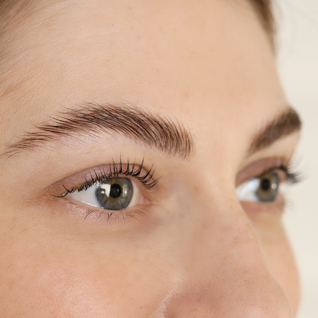 Brow Lift - Podizanje obrva - Poliklinika Arcadia